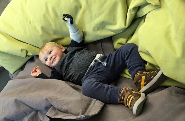 3D Printed Prosthetics Autodesk  - This Puts Prosthetics Within Financial Reach Of People Who Could Not Afford It Otherwise, Notably Children Due To The Need To Replace Their Prosthetics, More Often Than For Adults, As They Grow.