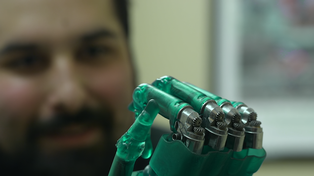 3D-printed prosthetic hands