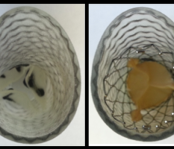 3D Printing Technology