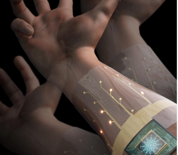 Biosensor armband could control prosthetics
